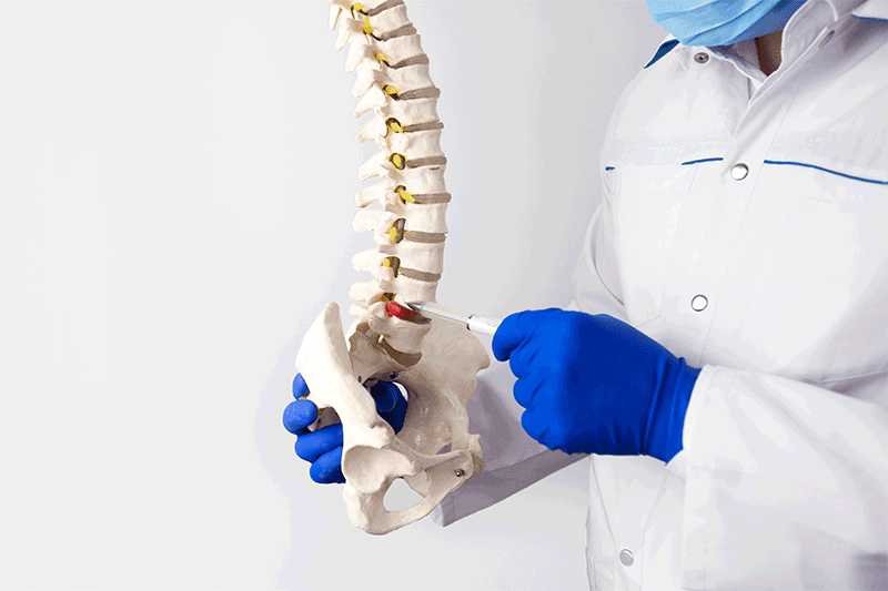 Treatments for Lumbar Herniated Discs