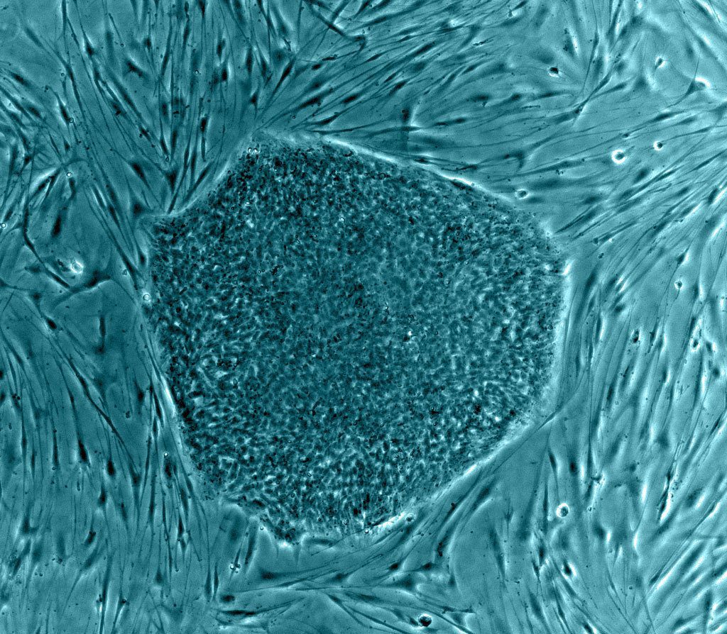 Kök Hücre: Tıbbın Geleceği