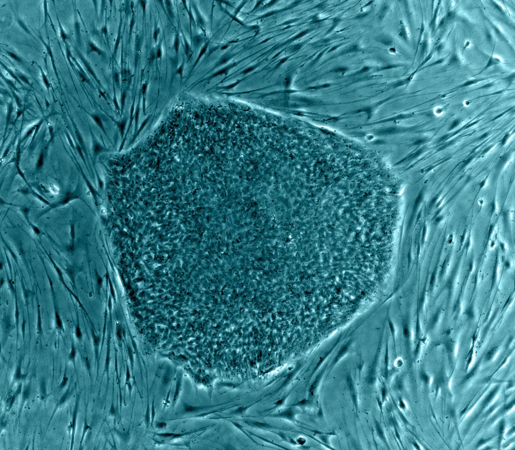 Stem Cells: The Future of Medicine